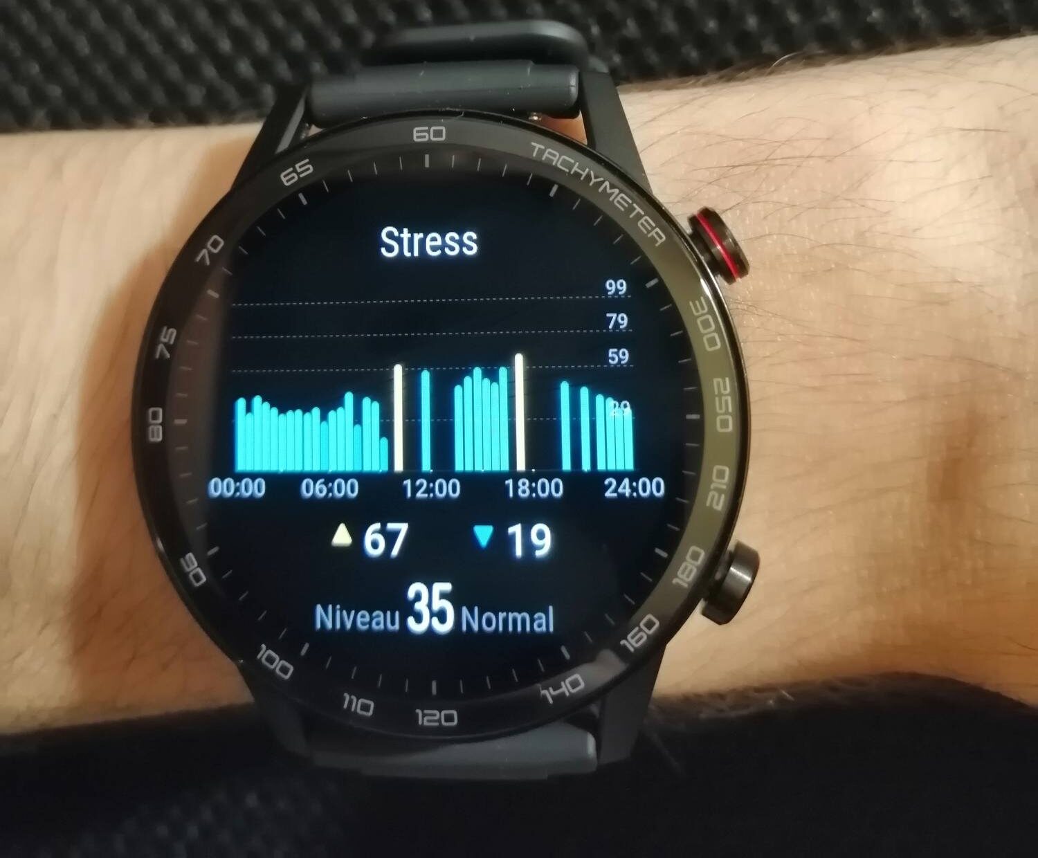 honor magic watch gt2